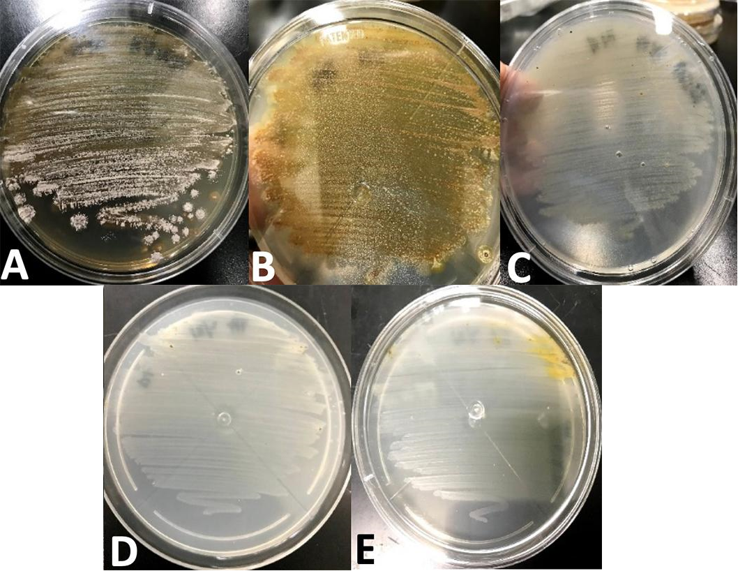 Bacteria from Mt. Mayon soils found with potential antibiotic, anticancer properties image